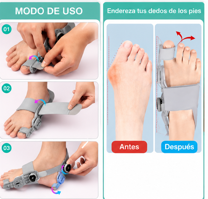 AlignStep™ | Corrector Ajustable para Juanetes